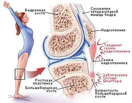 Картинки по запросу травмы коленного сустава