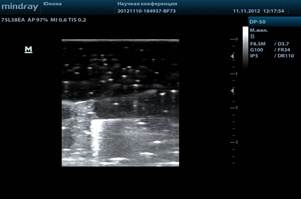 201211111225180016SMP