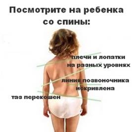 http://simzdorov.ru/wp-content/uploads/2014/02/skolioz-detej.jpg